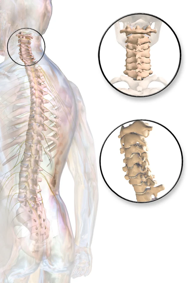 Columna cervical vista por detrás y de perfil, con las raíces nerviosas saliendo entre las vértebras